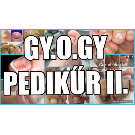 gyogy2